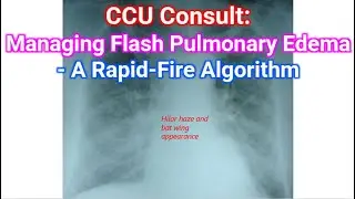 CCU Consult: Managing Flash Pulmonary Edema - A Rapid-Fire Algorithm
