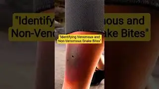 Identify Poisonous vs Non-Poisonous Snake Bites