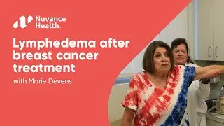 Lymphedema After Breast Cancer Treatment