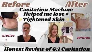I Lost Weight/My HONEST usage and review of RF 6:1 Cavitation machine/MyChway Part 1