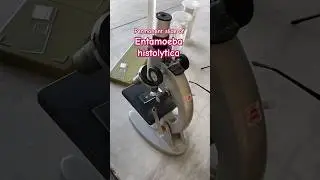 Entamoeba histolytica Under Microscope | Amoebiasis Causative Agent & Symptoms Explained #science