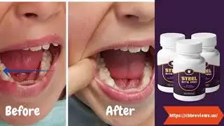 [2022] Steel Bite Pro Reviews - Negative Side Effects or Real Benefits?