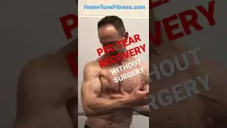 Pec Tear Recovery Without Surgery | How It Looks Now.💪🏽