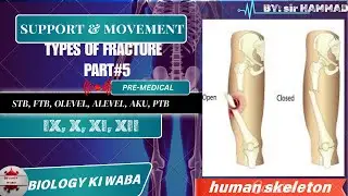 Type Of Fracture || Support And Movement || Biology || Class XII