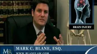 California Brain Injury Attorney:  Negligence Cases with Spinal Cord Injuries & Brain Trauma