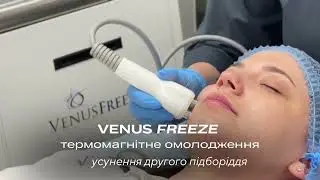 Venus Freeze | Термомагнітний RF-ліфтинг 