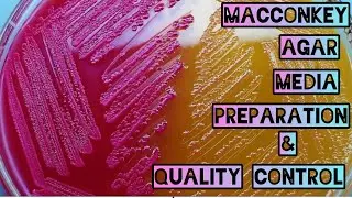 Macconkey Agar Media Preparation & Quality Control || Selective & Differtial Media ||