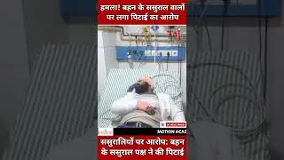 Agra News: बहन के ससुराल वालों पर लगा पिटाई का आरोप, ताजगंज पुलिस जांच में जुटी