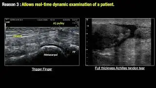 Introduction to MSKUS