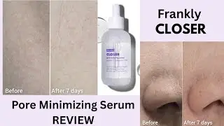 Pore-minimizing magic in a bottle! ✨   #franklyskincare #franklycloserserum