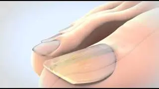 Nailner commercial - France