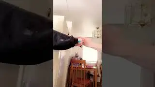 BROKE HIS PINKY FINGER!!🫠