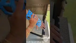 The Modern Plaster !? #fracture #bones #medical #facts #innovation #science #interesting #amazing