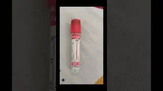 Vials and their test #hospital #bloodtest