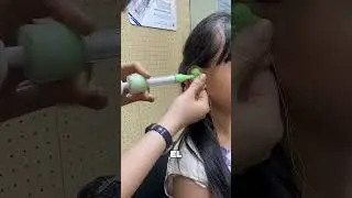 Limpieza Profunda De O&iacute;do Satisfactoria 😯❤️