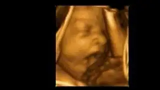 3D Ultrasound 30 weeks Yawning baby A New Conception 3D