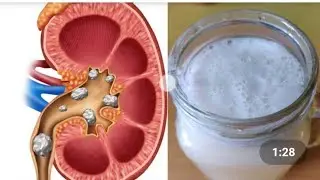 Radish juice benefits\Radish salad\Home remedy for kidney stones ,files, weight loss\
