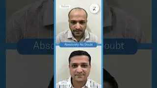 ZURI SKIN CLINIC I HAIR TRANSPLANTATION