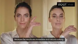 Dermal Fillers in Flower Mound/Dallas, TX: What They Improve Most