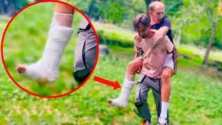 MI SONO ROTTO LA GAMBA **PRANK**