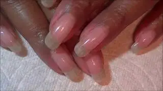 Nail Peeling UPDATE! My Nails are BACK!!