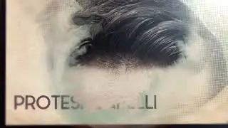 Prodotti da utilizzare per l&rsquo;ancoraggio per una PROTESI DI CAPELLI - Turismo capelli a Roma