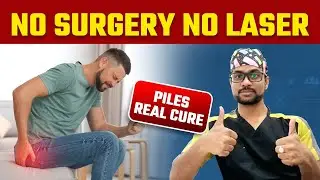 Hemorrhoid embolization, Piles treatment without surgery or lase