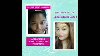 Amazing Lanelle Skin Care Whitening Results HIGHLY EFFECTIVE Skin Care by Lanelle Milanie Torralba