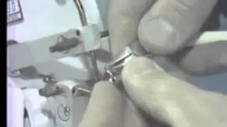 Orthodontic Spotwelding Technique