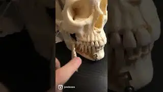 Настоящий человеческий череп!