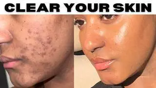 HOW TO LAYER YOUR SKINCARE PRODUCTS | The best products for clear skin
