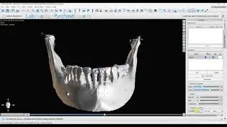 RadX - Convertendo DICOM para STL (Bluesky)
