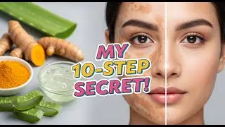 How I Faded Melasma Naturally: My 10-Step Remedy Routine