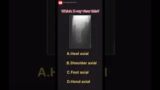🤔Which x-ray view this ?
