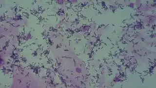 Infecunditatem. Cervix. Test Postcoital (PCT). IN VIVOS. 3h. Pap, linis.
