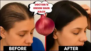 I Tried This Onion Hair Trick and WOW! Onion Juice for Extreme Hair Growth | Dr Madiha Bhayani