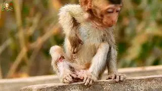 POOR BABY ALBA TOP HURT OF LEFT LEG SIT LONELY NO CARE BY MOM ANNA WALKING WITH HURT |