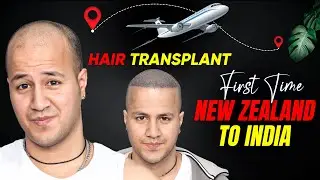 Hair Transplant in Hyderabad (HX-ZRUP) | Best Results & Cost of Hair Transplant in Hyderabad