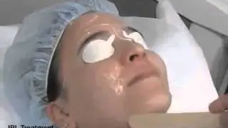 IPL Treatment | Cosmetic Laser Dermatology San Diego