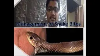 Management of Snake Bite | NEET PG | Dr. Akif Baig