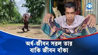 ২৮ বছর ধরে কুঁজো হয়ে চলছেন ৫৩ বছরের মজিদ মিয়া | Human Story | Rare Disease | Tangail