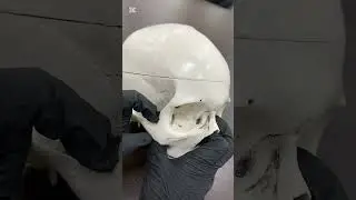 Head and neck lecture 1
