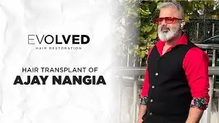 Ajay Nangia&rsquo;s Brilliant Hair Transplant Transformation | Evolved Hair Restoration&rdquo;
