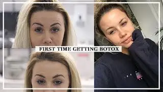 Botox: My First Experience, What To Expect, Before/After | Copper Garden