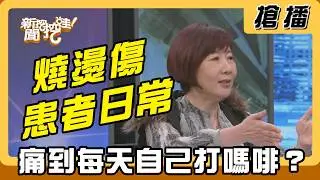 【搶播】燒燙傷患者日常 痛到每天自己打嗎啡？