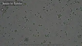 псевдо L- Lyme ? spirochete Borrelia ? Микоплазма ? Споровик ?Дьявол из крови. Кто живёт в Крови ?