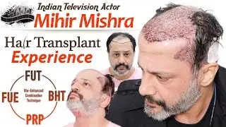 Celeb Hair Transplant in India | ACTOR MIHIR Mishra Surgery | MEDISPA India | Dr. Suneet Soni |India