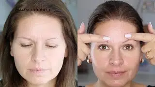 Das Ergebnis:  Revitalift Filler Review Faltenkiller / More Mamaco