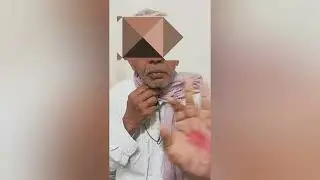 Post laryngectomy voice prosthesis for cancer of larynx