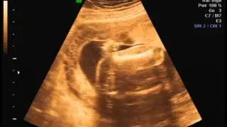 Isabella Cristina Fidelis da Silva